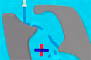 Water Crysis